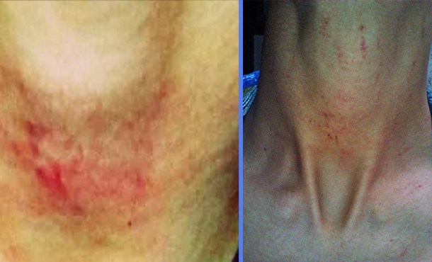 Le jeune S. K. porte les traces des violences dont il a été victimes