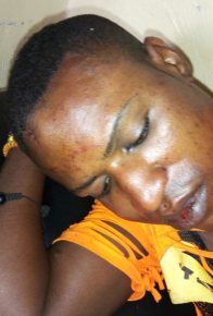 Transgenre, attaqué et blessé à Bukavu, Congo, reste&nbsp;isolé