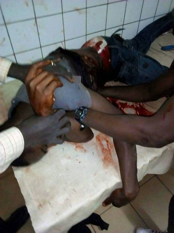 Attaqué par des militaires à Garoua, Hassan Mouktar est mort à l'hôpital. (Photo de l'Association jeunes solidaire de Garoua)