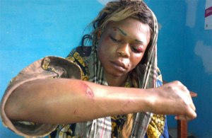 Delores attaquée le 19 janvier 2015.