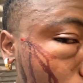 RD. Congo : Violent guet-apens homophobe à&nbsp;Bukavu